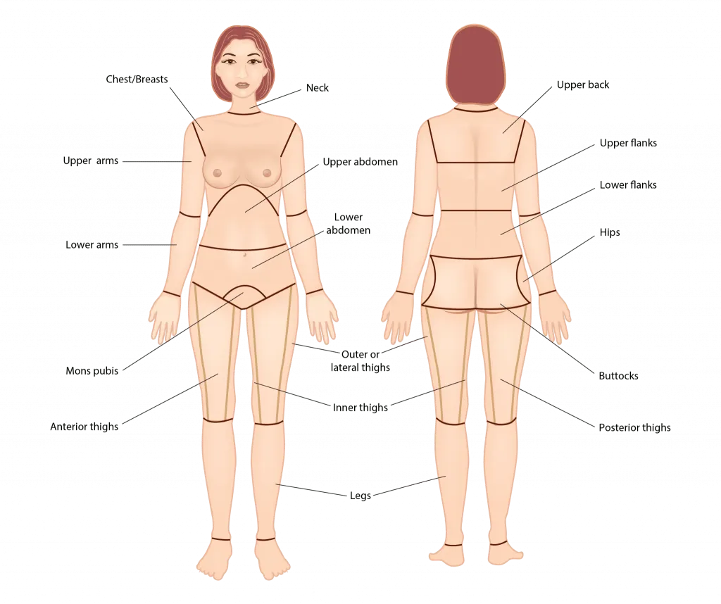 Liposuction Surgery