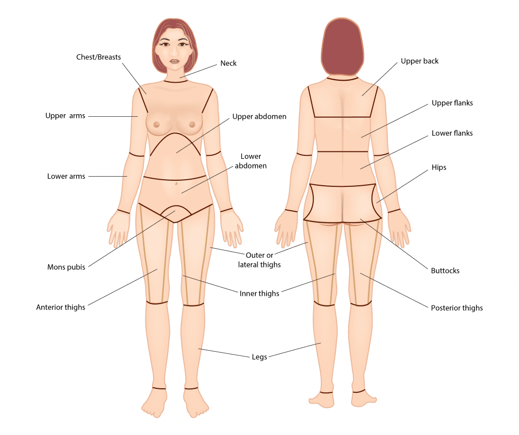 Liposuction areas