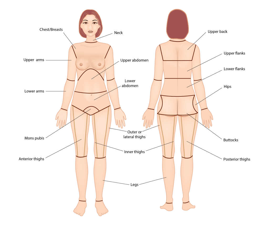 Liposuction Areas