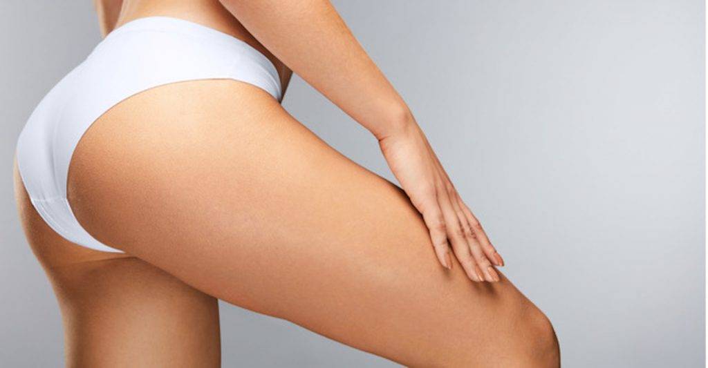 Closeup Of A Woman Legs With Saddlebags