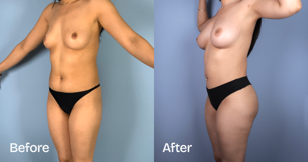 Before And After Gallery